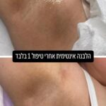 תמונה של WhatsApp‏ 2024-11-26 בשעה 00.53.04_a092ef3b